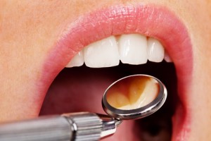 Dental Malpractice